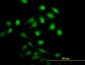 NME1 Antibody (monoclonal) (M01)